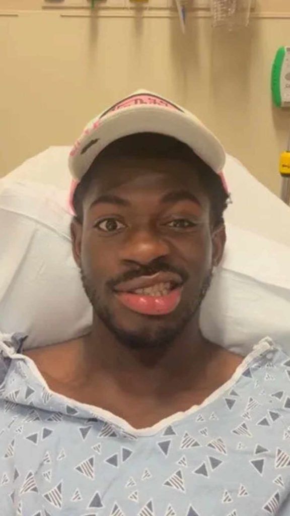 Lil Nas X preocupa a sus fans tras revelar parálisis facial en un impactante video